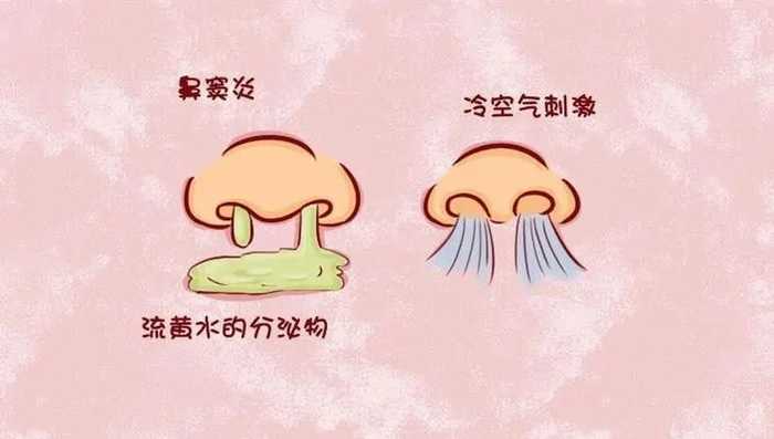 為什么兒童鼻竇炎難治？治療兒童鼻竇炎的經(jīng)驗(yàn)用藥